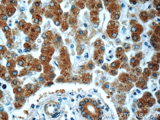 [24658-1-AP-150UL] PHKA2 Polyclonal antibody