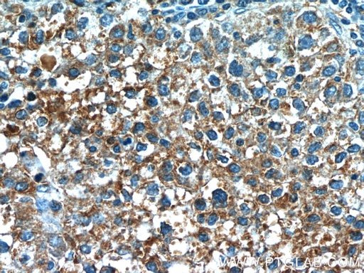 [24659-1-AP-20UL] VN1R3 Polyclonal antibody