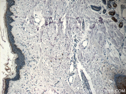 [24661-1-AP-150UL] SPINK9 Polyclonal antibody