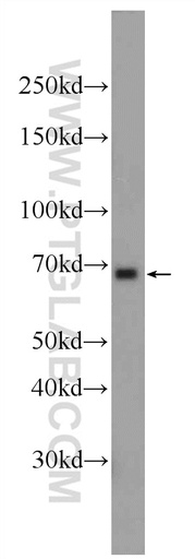 [24664-1-AP-150UL] RBPJL Polyclonal antibody