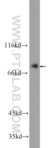 [24665-1-AP-150UL] ZBTB48 Polyclonal antibody