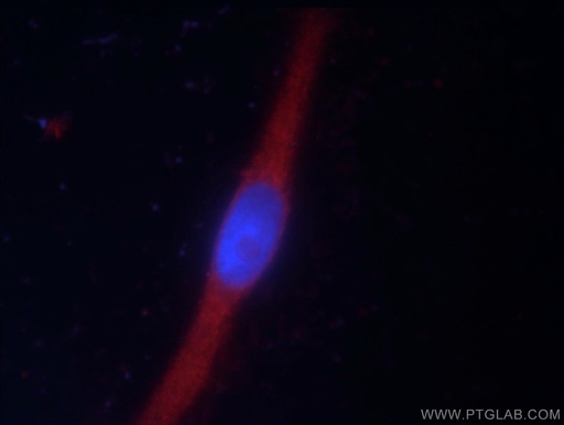 [24666-1-AP-150UL] LRSAM1 Polyclonal antibody