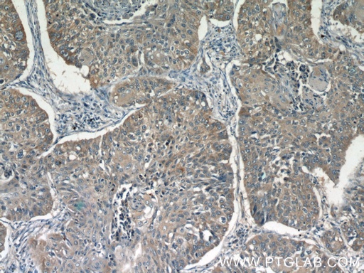 [24674-1-AP-150UL] GGT7 Polyclonal antibody