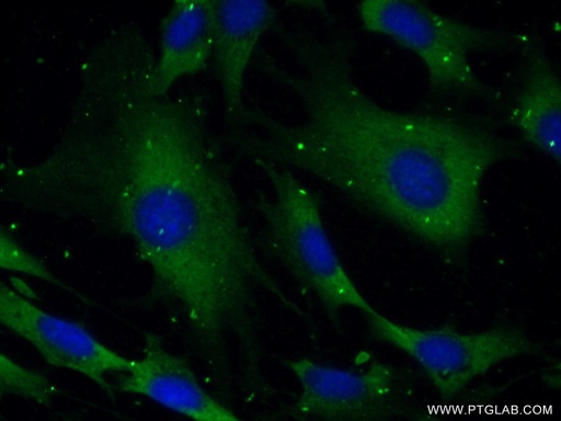 [24677-1-AP-150UL] SYNJ1 Polyclonal antibody
