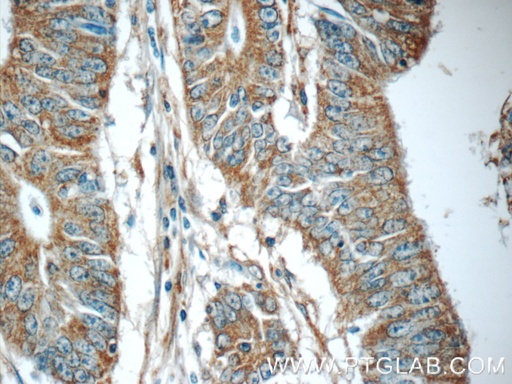 [24678-1-AP-20UL] C20orf46 Polyclonal antibody