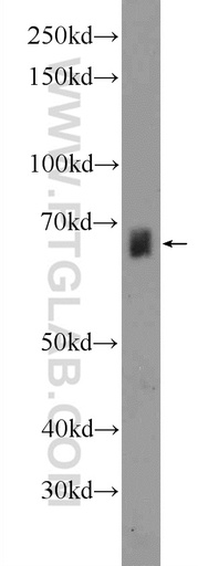 [24681-1-AP-20UL] ZNF284 Polyclonal antibody