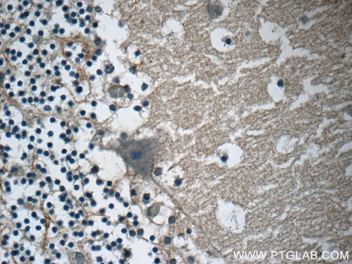 [24687-1-AP-150UL] AMMECR1 Polyclonal antibody