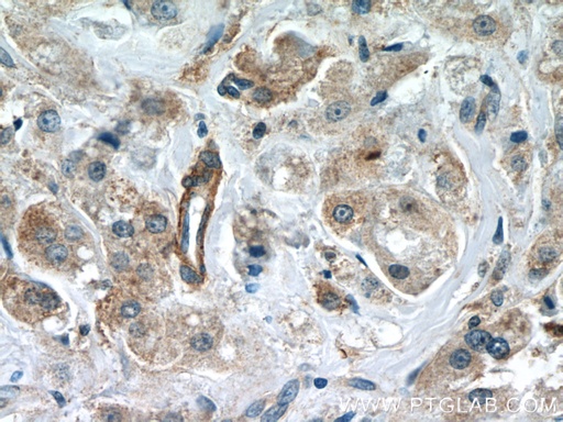[24689-1-AP-150UL] CCDC99 Polyclonal antibody
