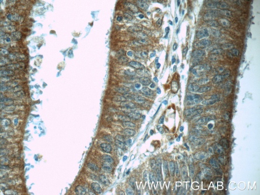 [24690-1-AP-20UL] C6orf70 Polyclonal antibody