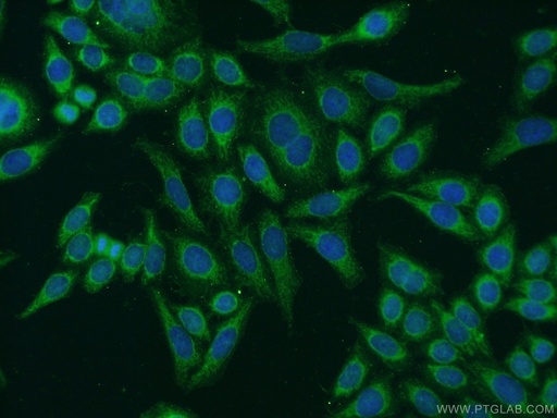 [24691-1-AP-150UL] EYA4 Polyclonal antibody