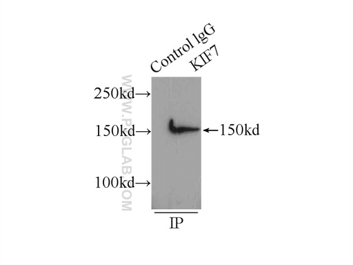 [24693-1-AP-20UL] KIF7 Polyclonal antibody