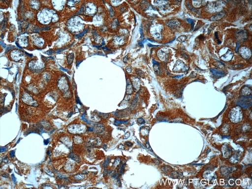 [24697-1-AP-20UL] MN1 Polyclonal antibody