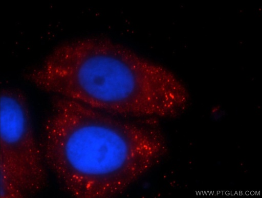 [24698-1-AP-20UL] C5orf26 Polyclonal antibody