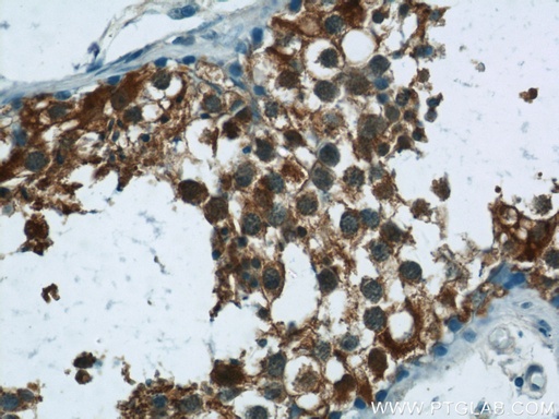 [24708-1-AP-150UL] RNF151 Polyclonal antibody