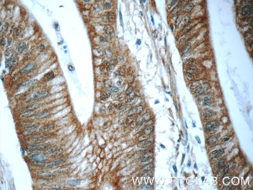 [24711-1-AP-150UL] BEND4 Polyclonal antibody