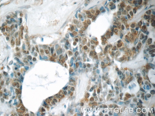 [24717-1-AP-150UL] YEATS2 Polyclonal antibody