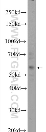 [24720-1-AP-20UL] ZFP2 Polyclonal antibody