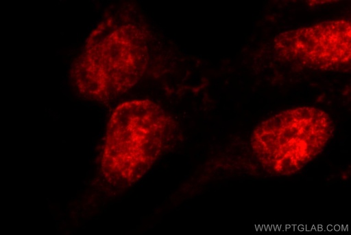 [24721-1-AP-150UL] MDC1 Polyclonal antibody