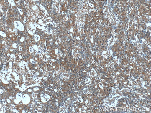 [24723-1-AP-150UL] IL-36 Gamma Polyclonal antibody