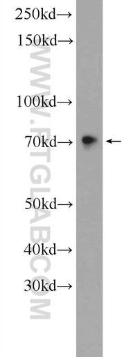 [24731-1-AP-20UL] SAMD11 Polyclonal antibody