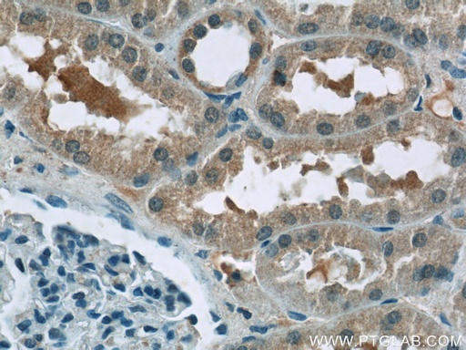 [24733-1-AP-20UL] BTBD16 Polyclonal antibody