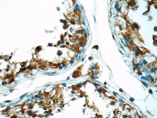 [24736-1-AP-150UL] ODF1 Polyclonal antibody