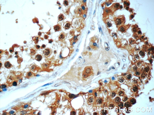 [24741-1-AP-20UL] HYDIN Polyclonal antibody