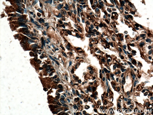 [24743-1-AP-150UL] ACE Polyclonal antibody
