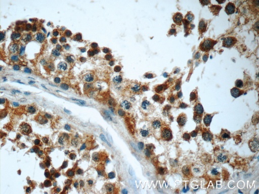 [24746-1-AP-20UL] FAM8A1 Polyclonal antibody