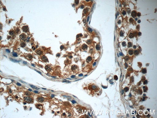 [24757-1-AP-20UL] RPS6KL1 Polyclonal antibody