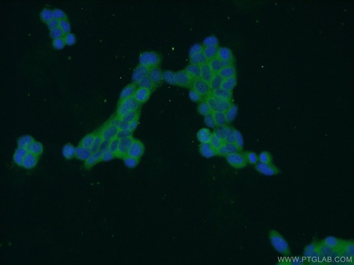 [24759-1-AP-20UL] ZDHHC13 Polyclonal antibody