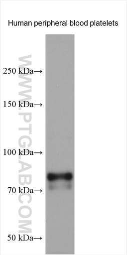 [24760-1-AP-20UL] TPOR/MPL  Polyclonal antibody