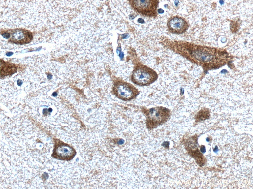 [24761-1-AP-150UL] PTGER3 Polyclonal antibody