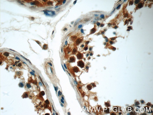 [24762-1-AP-20UL] MUM1L1 Polyclonal antibody