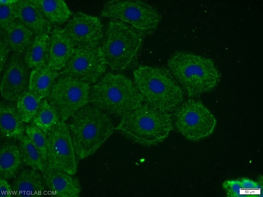 [24769-1-AP-150UL] TOR1AIP2 Polyclonal antibody