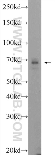 [24770-1-AP-150UL] SCC4 Polyclonal antibody