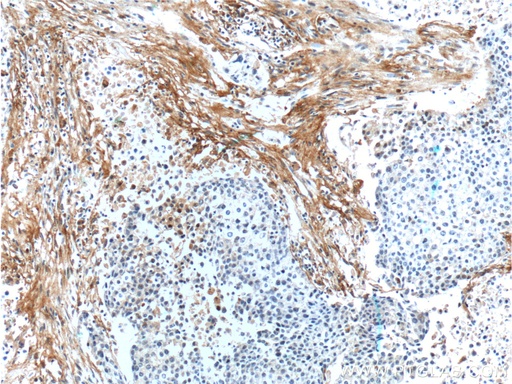 [24779-1-AP-20UL] EMILIN2 Polyclonal antibody