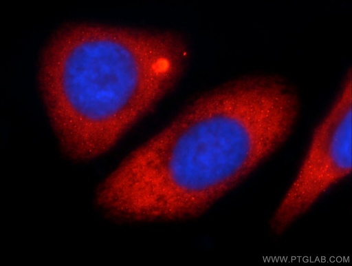 [24781-1-AP-20UL] KLHL31 Polyclonal antibody