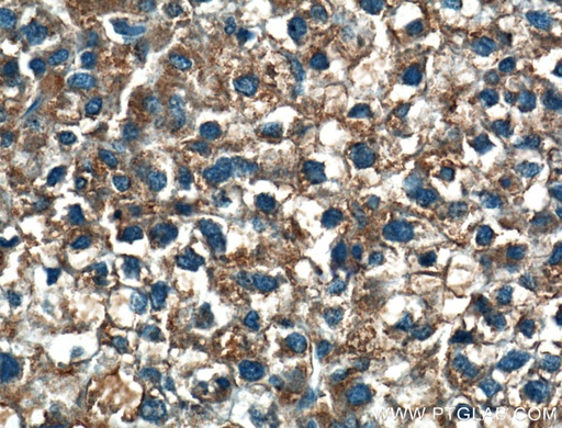 [24782-1-AP-20UL] MOSC2 Polyclonal antibody