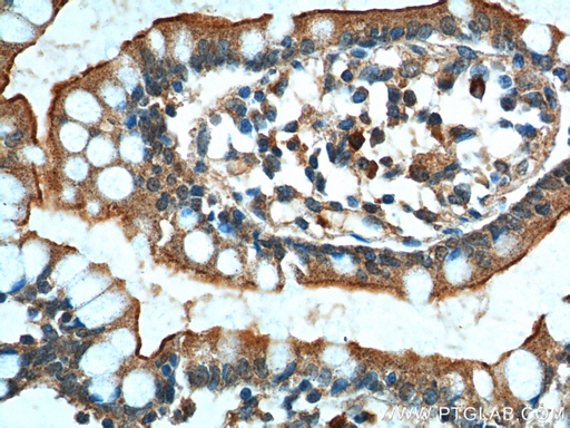 [24784-1-AP-150UL] GPR128 Polyclonal antibody