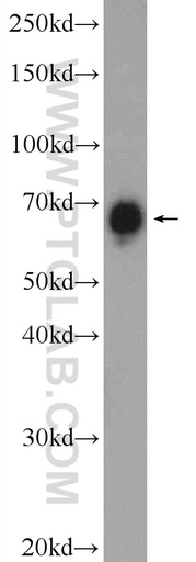 [24785-1-AP-20UL] BRD9 Polyclonal antibody