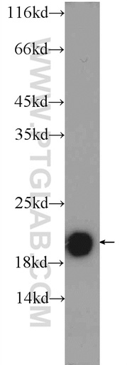 [24786-1-AP-150UL] TMEM35 Polyclonal antibody