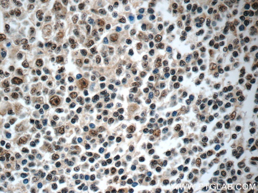 [24792-1-AP-150UL] NALP1 Polyclonal antibody