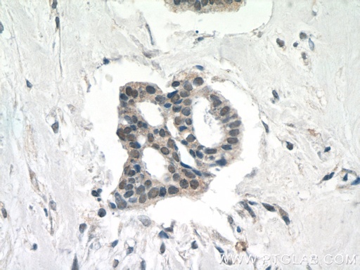 [24793-1-AP-150UL] INO80C Polyclonal antibody