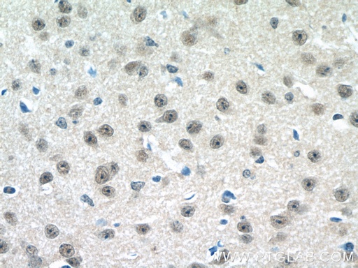[24795-1-AP-20UL] C15orf29 Polyclonal antibody