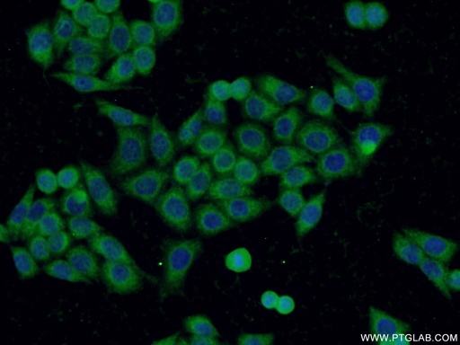 [24797-1-AP-150UL] C19orf61 Polyclonal antibody