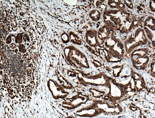 [24799-1-AP-20UL] TMEM179 Polyclonal antibody