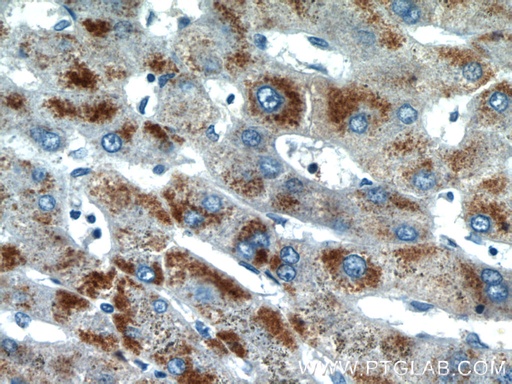[24801-1-AP-20UL] PXMP2 Polyclonal antibody