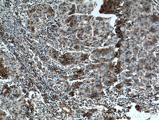 [24802-1-AP-150UL] FAM174A Polyclonal antibody