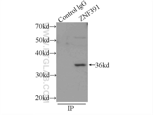 [24805-1-AP-20UL] ZNF391 Polyclonal antibody